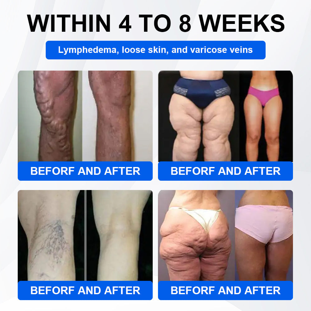 Official Store | LBMLBM® SMGT-GLP-1 Nano Microneedle Patch with Collagen & Matrixyl 3000