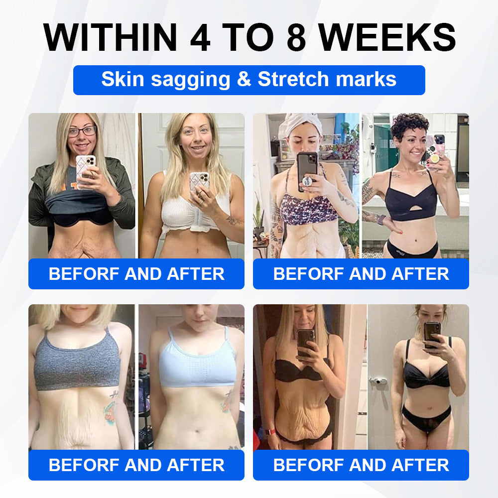 Official Store | LBMLBM® SMGT-GLP-1 Nano Microneedle Patch with Collagen & Matrixyl 3000