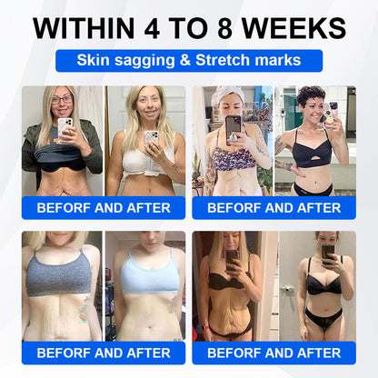 Official Store | LBMLBM® SMGT-GLP-1 Nano Microneedle Patch with Collagen & Matrixyl 3000