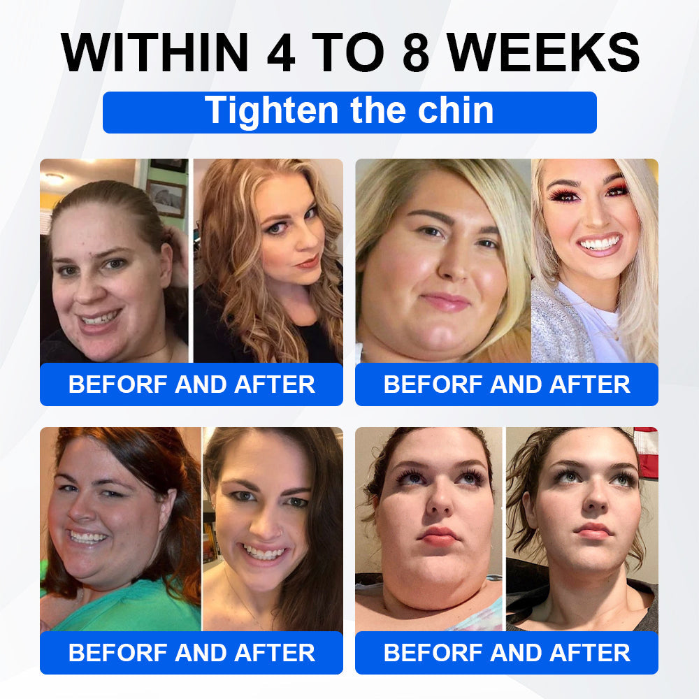 Official Store | LBMLBM® SMGT-GLP-1 Nano Microneedle Patch with Collagen & Matrixyl 3000