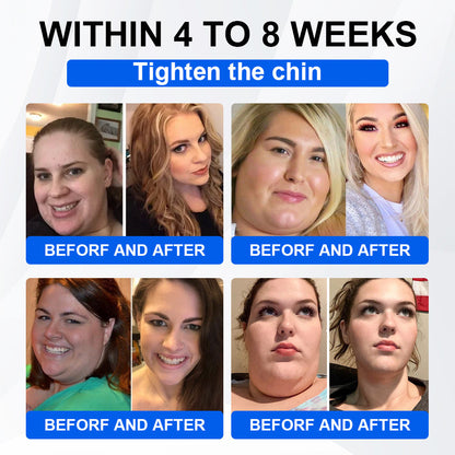 Official Store | LBMLBM® SMGT-GLP-1 Nano Microneedle Patch with Collagen & Matrixyl 3000