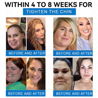 ✅ Best Seller-LBMLBM® SMGT-GLP-1 𝐓𝐢𝐫𝐳𝐞𝐩𝐚𝐭𝐢𝐝𝐞 & 𝐂𝐨𝐥𝐥𝐚𝐠𝐞𝐧 𝐍𝐚𝐧𝐨 𝐌𝐢𝐜𝐫𝐨𝐧𝐞𝐞𝐝𝐥𝐞 𝐖𝐞𝐢𝐠𝐡𝐭 𝐋𝐨𝐬𝐬 𝐏𝐚𝐭𝐜𝐡丨Targets Obesity, Loose Skin, High Blood Pressure, Diabetes, Fatty Liver, Joint Pain, Brain Fog, Low Energy, Body Aches, and More